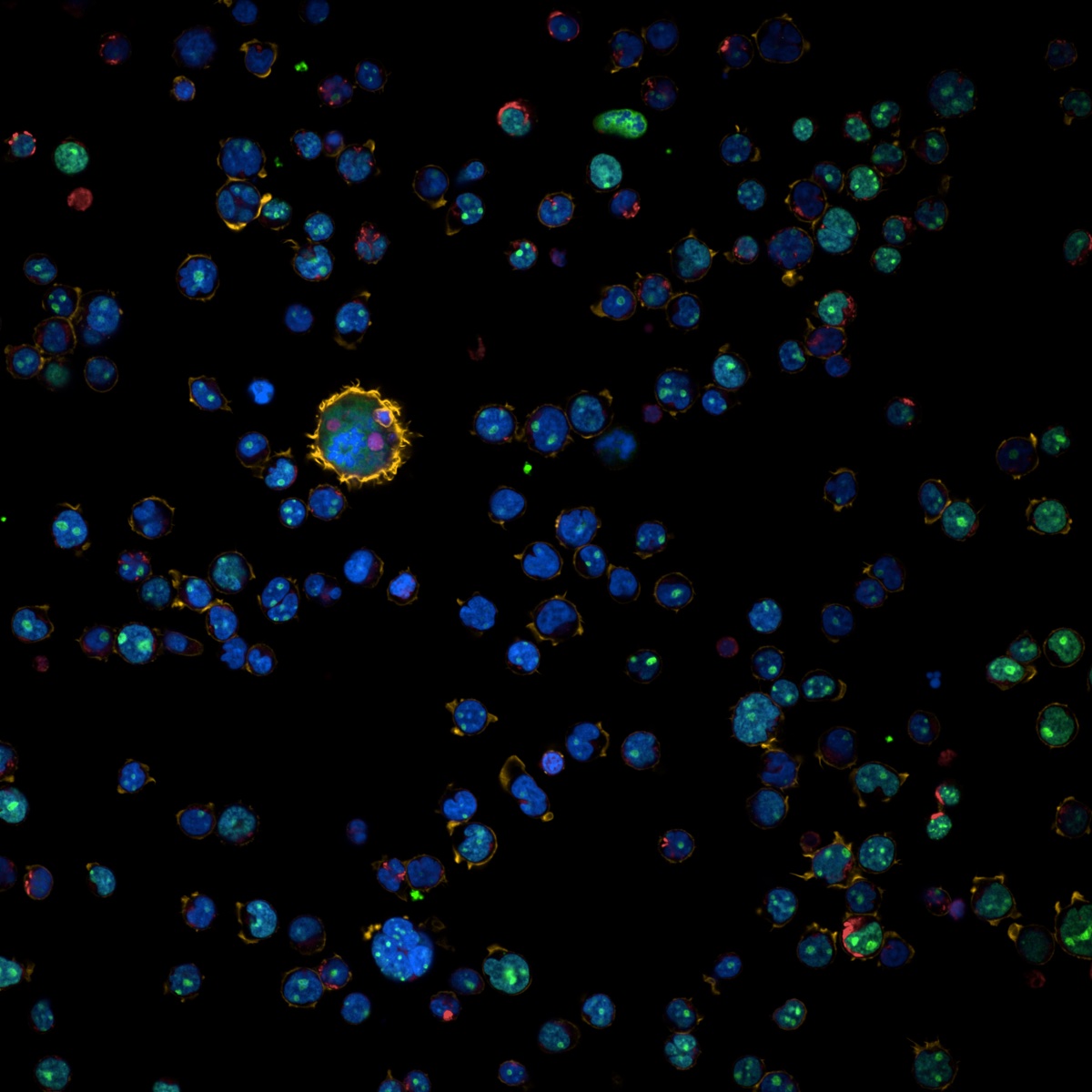 High-content microscopy image of Jurkat cells